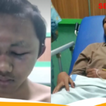 Mahasiwa Undip Dikeroyok 30 Temannya