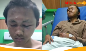 Mahasiwa Undip Dikeroyok 30 Temannya