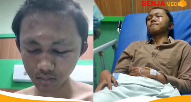 Mahasiwa Undip Dikeroyok 30 Temannya