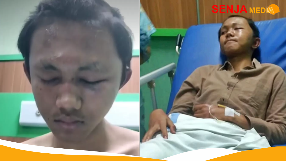 Mahasiwa Undip Dikeroyok 30 Temannya